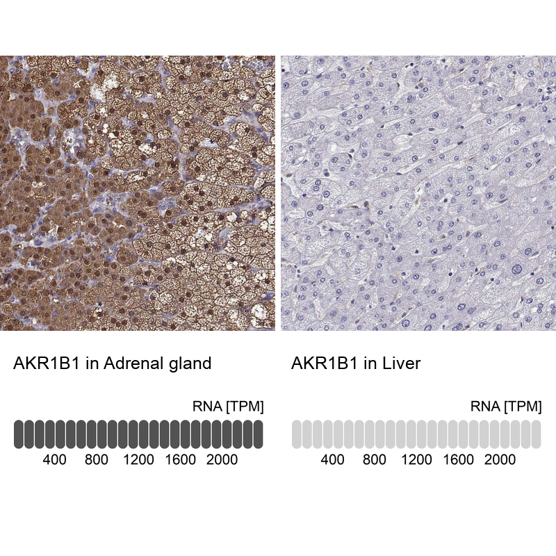 Anti-AKR1B1 Antibody