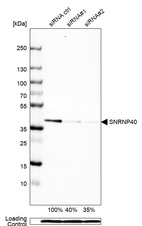 Anti-SNRNP40 Antibody