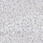 Anti-HCN3 Antibody