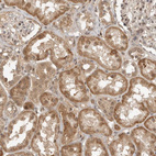 Anti-ASPSCR1 Antibody