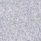 Anti-KCNJ1 Antibody