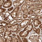 Anti-DCAF8 Antibody