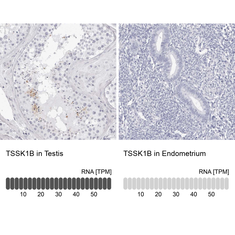 Anti-TSSK1B Antibody