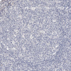 Anti-ZYG11B Antibody