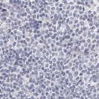 Anti-CA6 Antibody