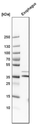 Anti-GPR157 Antibody