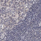Anti-ANXA9 Antibody