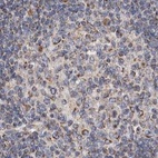 Anti-MRPL18 Antibody