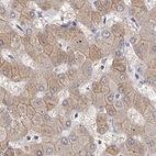 Anti-MRPL18 Antibody