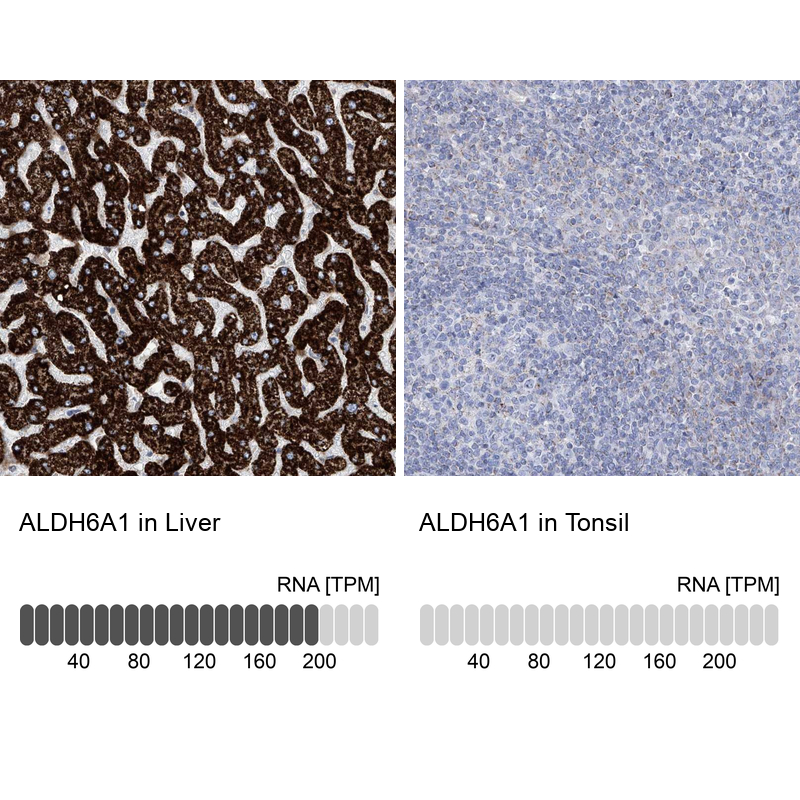 Anti-ALDH6A1 Antibody