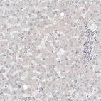 Anti-RABAC1 Antibody