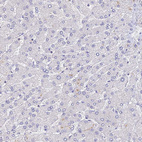 Anti-SLC11A1 Antibody