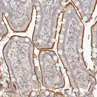 Anti-LTB4R2 Antibody