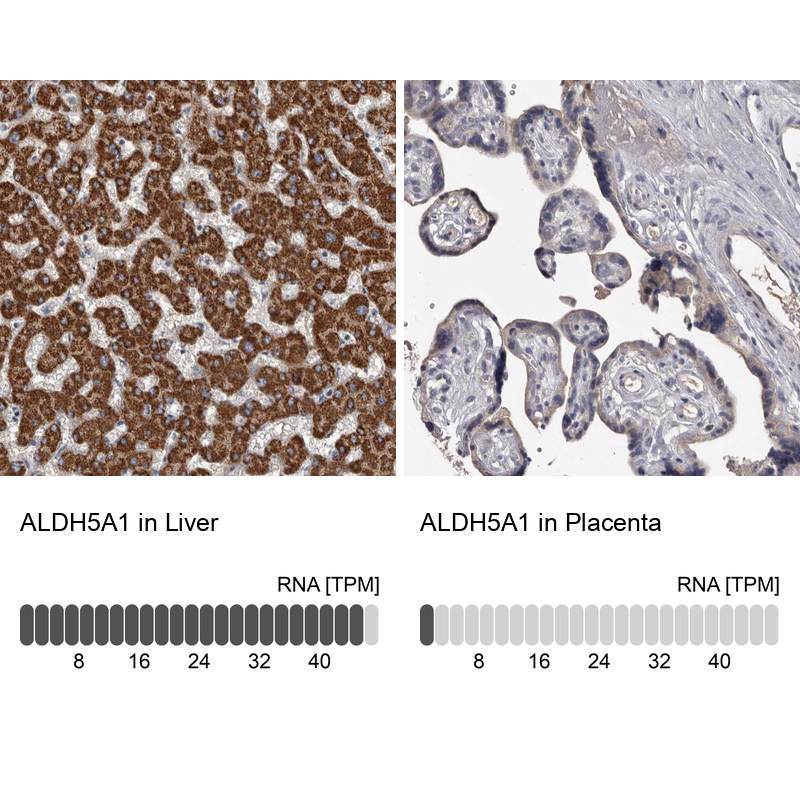 Anti-ALDH5A1 Antibody