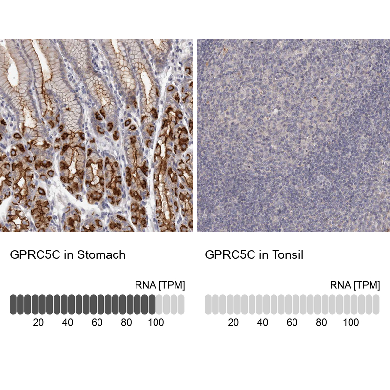 Anti-GPRC5C Antibody