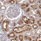Anti-GPRC5C Antibody