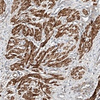 Anti-ARHGAP33 Antibody