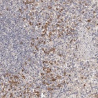 Anti-USP49 Antibody