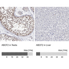 Anti-ABCF2 Antibody