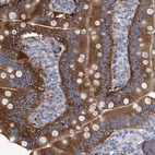 Anti-XPNPEP1 Antibody