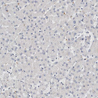 Anti-ITGA2B Antibody