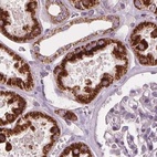 Anti-ECI2 Antibody