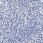 Anti-CTRL Antibody