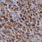 Anti-GPR155 Antibody