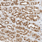 Anti-TMEM87B Antibody