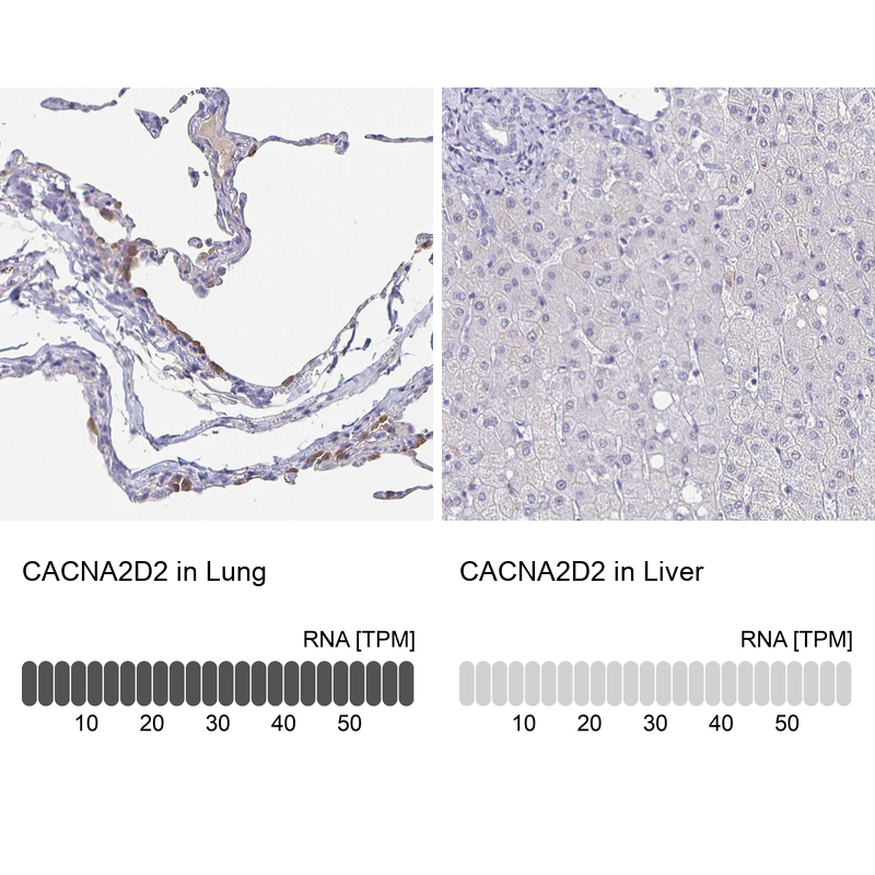 Anti-CACNA2D2 Antibody