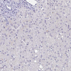 Anti-CACNA2D2 Antibody