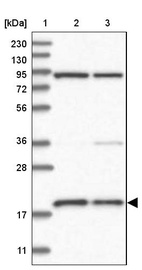 Anti-MRPS18A Antibody