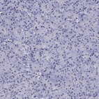 Anti-PPM1G Antibody