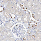 Anti-PAFAH1B3 Antibody