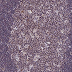 Anti-CDC7 Antibody