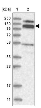 Anti-RBM15B Antibody