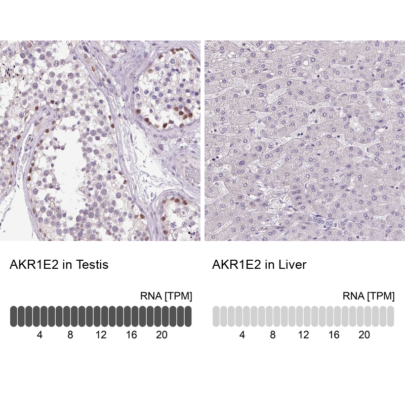 Anti-AKR1E2 Antibody