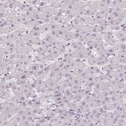 Anti-AKR1E2 Antibody