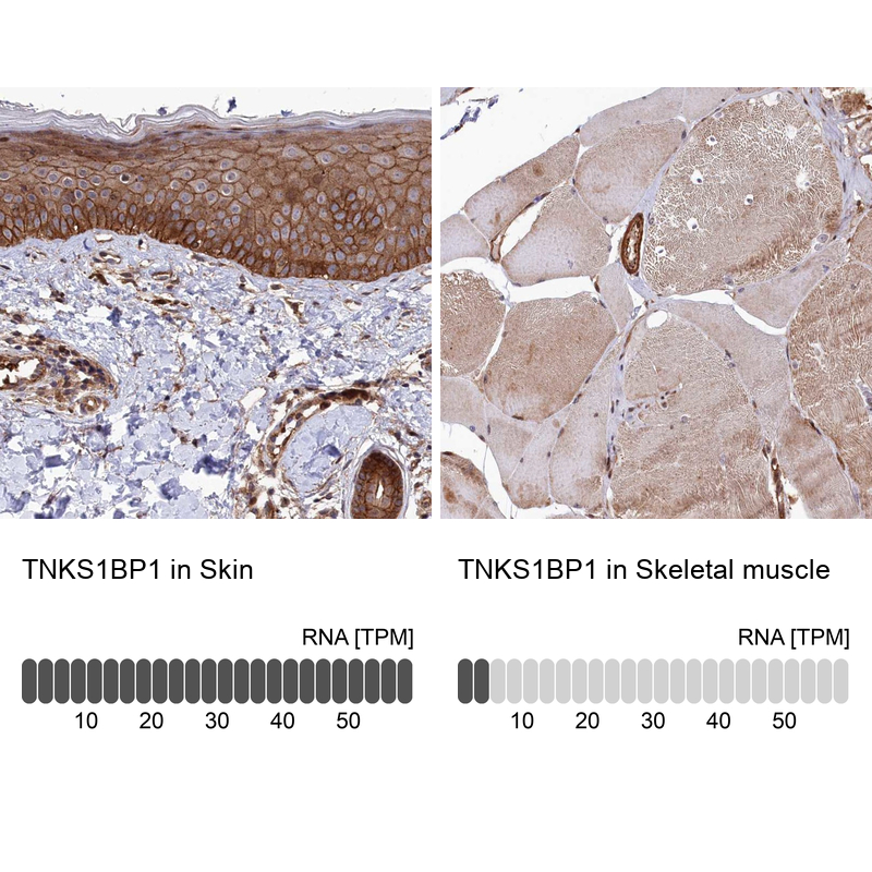 Anti-TNKS1BP1 Antibody