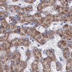 Anti-MCCC2 Antibody
