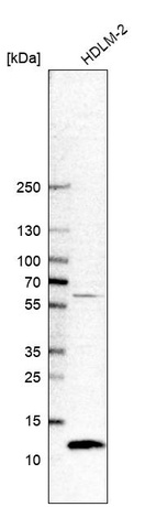 Anti-CDC42SE2 Antibody
