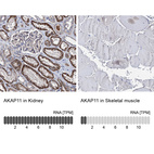 Anti-AKAP11 Antibody