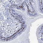 Anti-MFSD5 Antibody