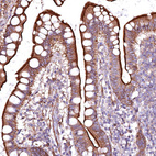 Anti-GPR176 Antibody