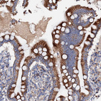 Anti-SLC10A7 Antibody