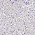 Anti-NUTM1 Antibody