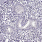 Anti-NUTM1 Antibody