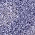 Anti-TMC3 Antibody