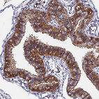 Anti-SLC16A14 Antibody