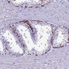 Anti-CDAN1 Antibody